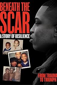 watch-Beneath the Scar: A Story of Resilience (2025)