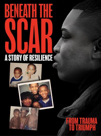 watch-Beneath the Scar: A Story of Resilience (2025)