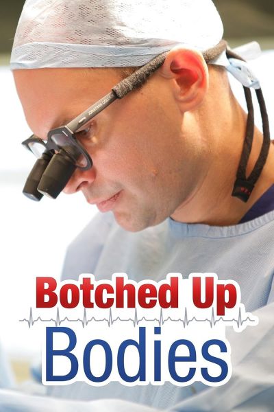 watch-Botched Up Bodies (2013)