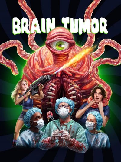 watch-Brain Tumor (2024)
