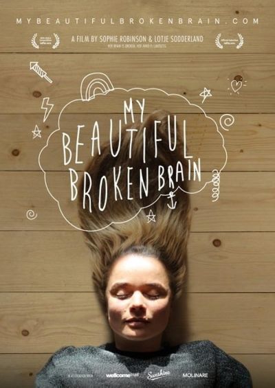 watch-My Beautiful Broken Brain (2016)