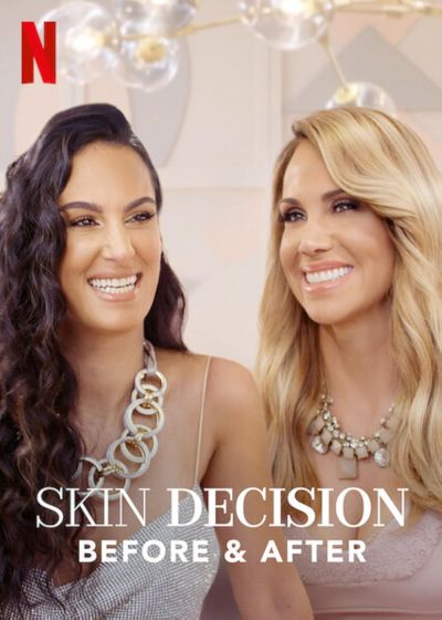 watch-Skin Decision: Before and After (2020)